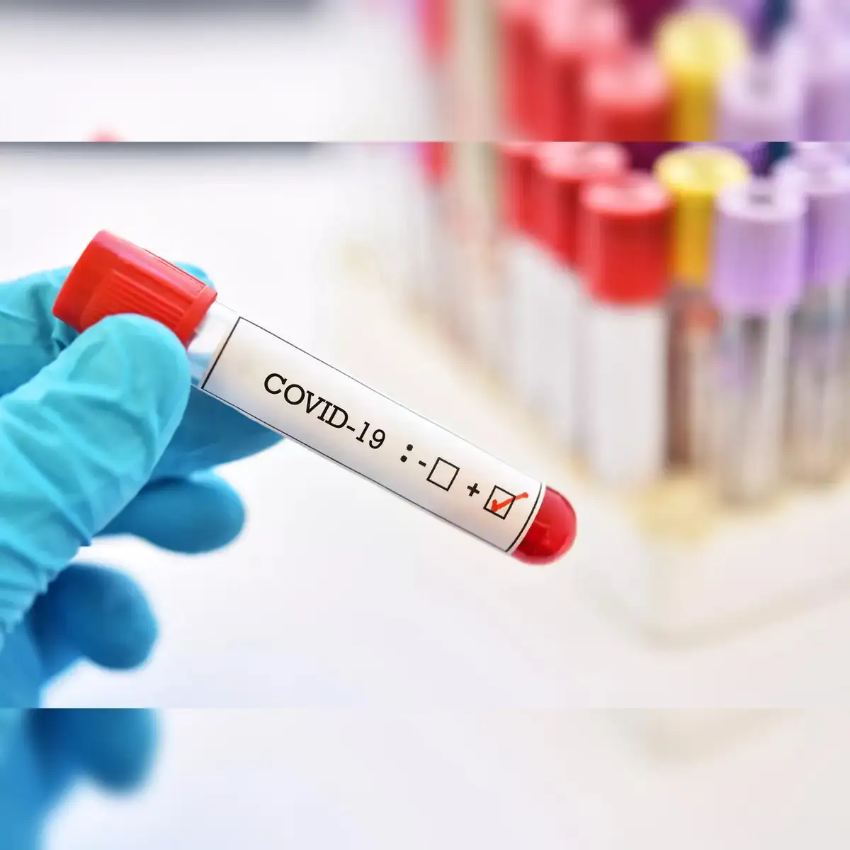 India Sees 1,009 Active COVID Cases, Experts Urge Calm